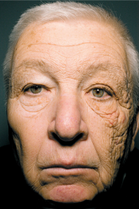 Uroda 40 plus - promieniowanie UVA - szkodliwy wpływ słońca na skórę