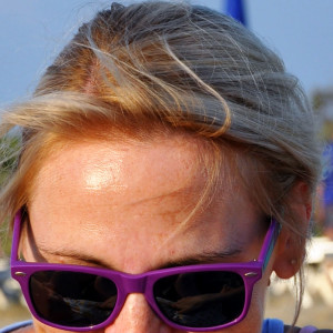 Złuszczanie a przebarwienia - Uroda 40 plus