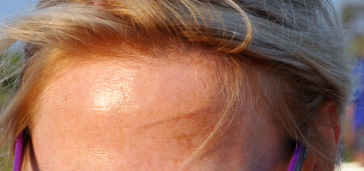 Złuszczanie a przebarwienia - Uroda 40 plus