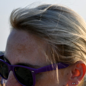 Złuszczanie a przebarwienia - Uroda 40 plus