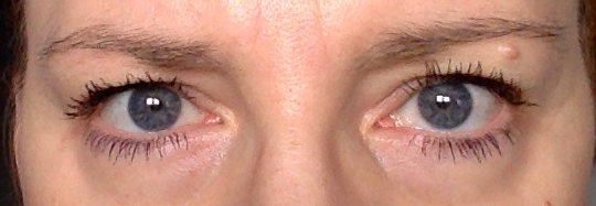 Uroda 40 plus - ćwiczenia na opadające powieki